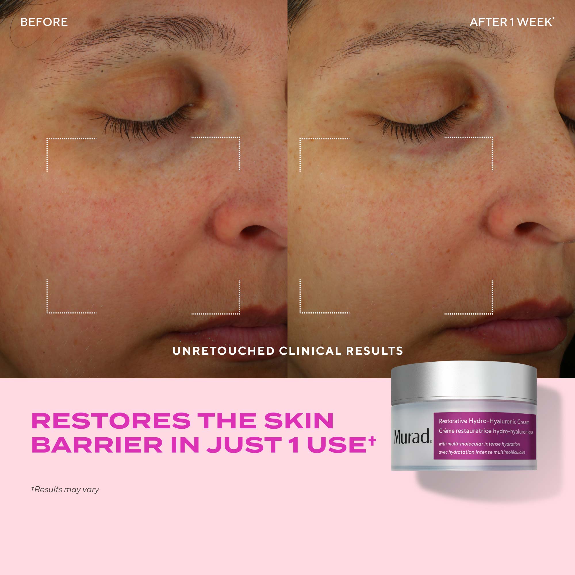 Dewy Skin Hydration Discovery Kit - Image 7