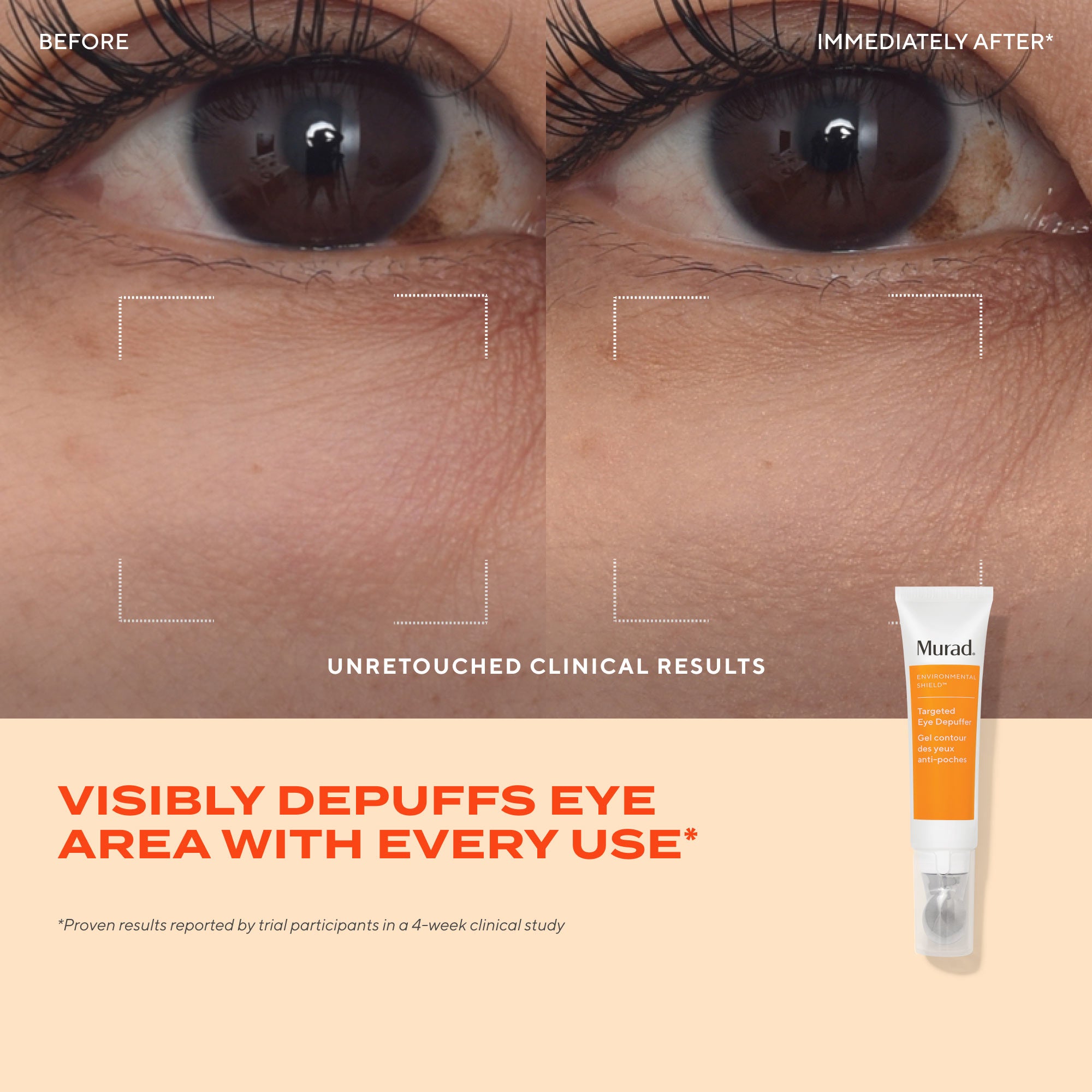 Targeted Eye Depuffer - Image 3