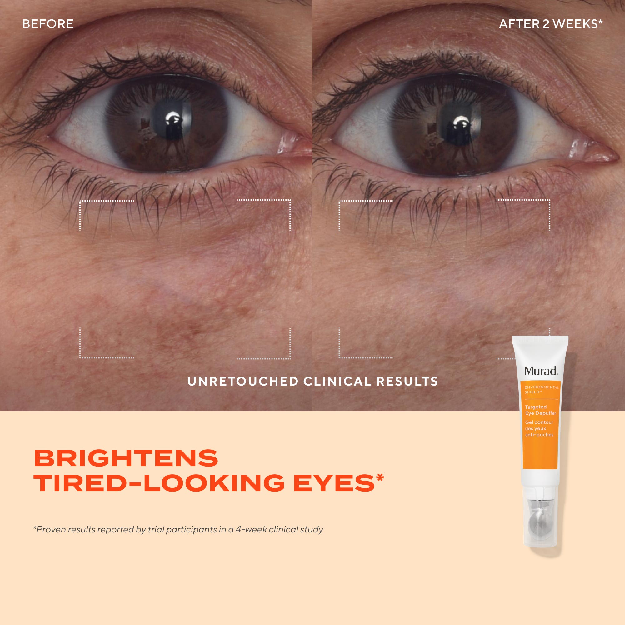 Targeted Eye Depuffer - Image 4