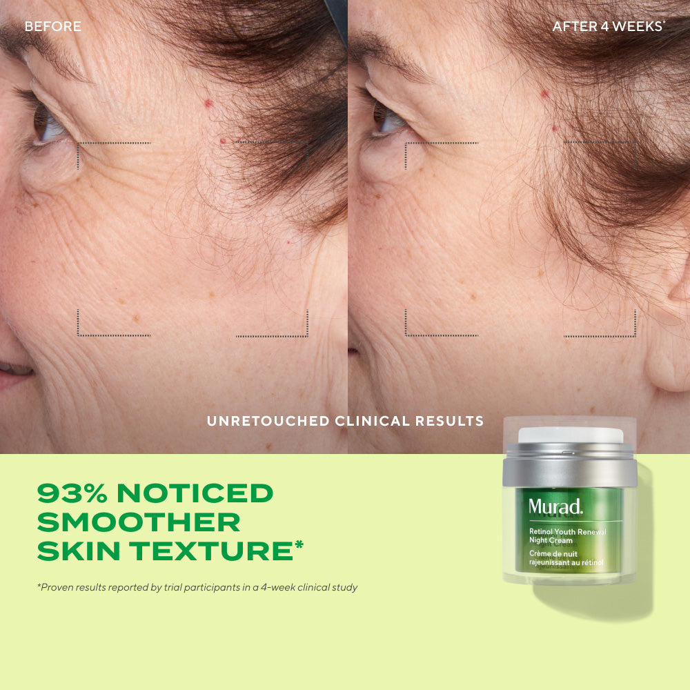 Active Renewal Regimen 90-Day Kit - Image 3